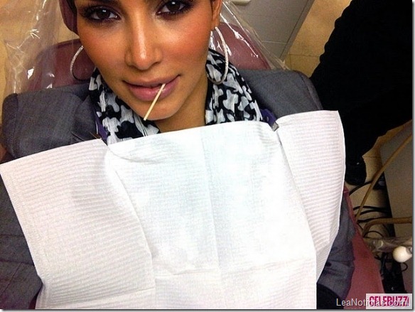Kim-Kardashian-at-the-Dentist-580x435