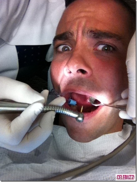 Mark-Salling-at-the-Dentist-435x580