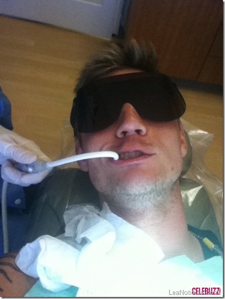 Nick-Carter-at-the-Dentist-435x580
