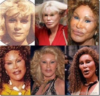 Jocelyn Wildenstein