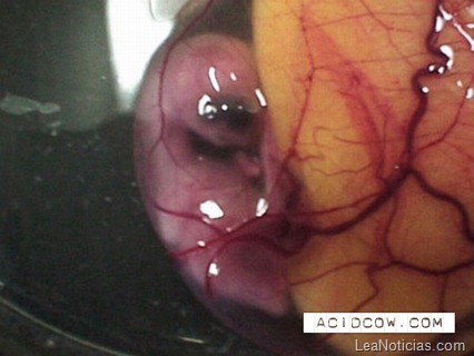 clip_image011 clip_image011