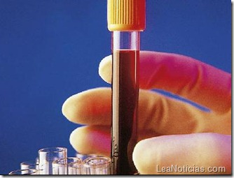sangre bionalisis ministerio de salud