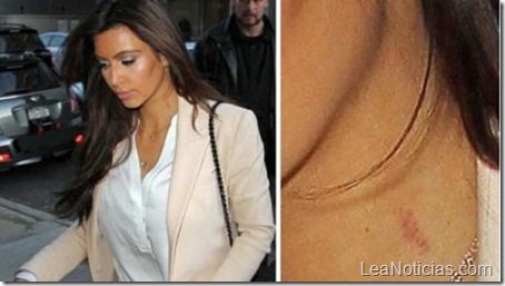 Kim Kardashian con mordeduras en el cuello