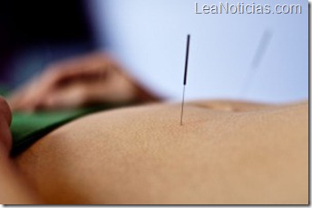 acupuntura-para-bajar-de-peso-300x199