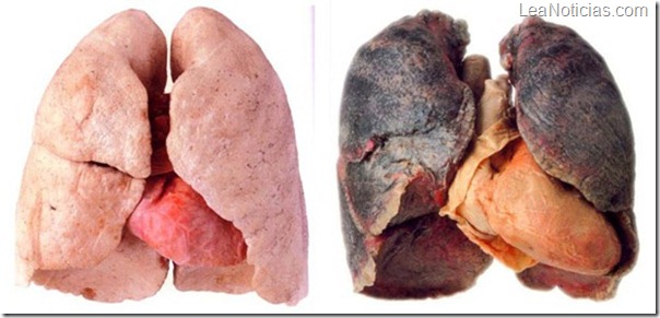 pulmones-sanos-y-de-fumador