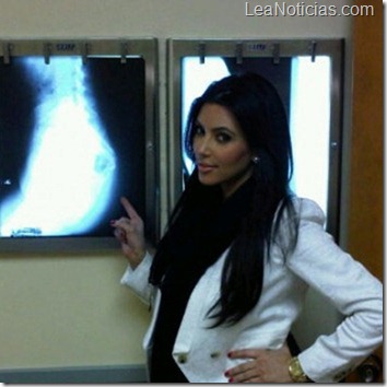 kim-kardashian-radiografia-trasero1