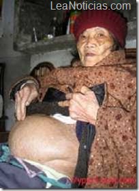 anciana-92-con-litopedia