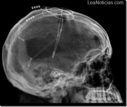 skulldiode3d-2