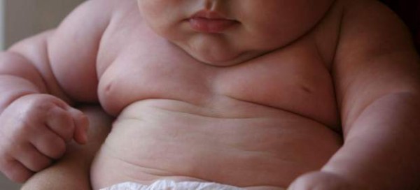 obesidad-infantil-hereditaria