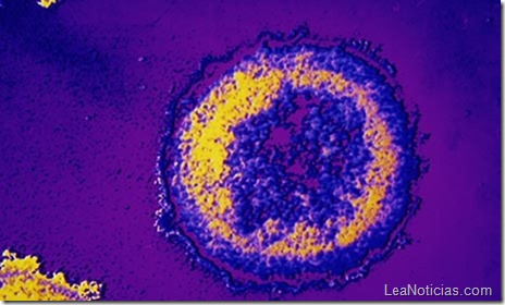 virus-vih