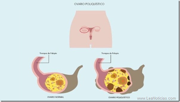 ovarios-sistema-reproductor-femenino