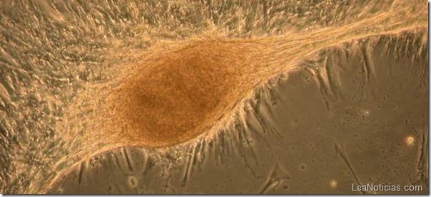 regeneran-higado-celulas-madres