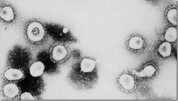 get-virus-sars