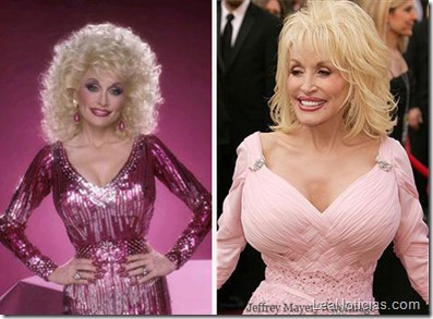 Dolly-Parton-10-famosos-que-arruinaron-su-belleza-con-cirugías-plasticas