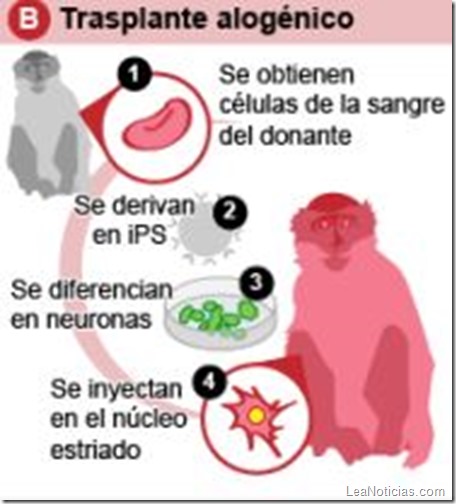 transplante alogénico