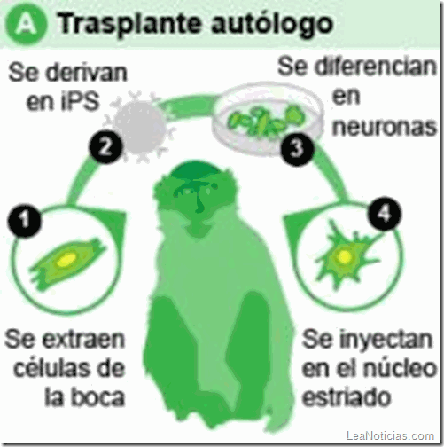 transplante autólogo1