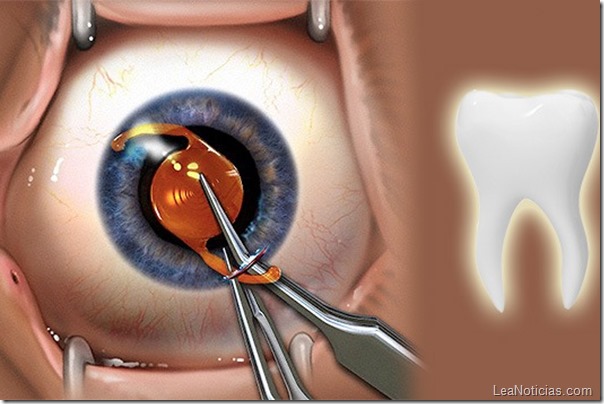 operacion ojo