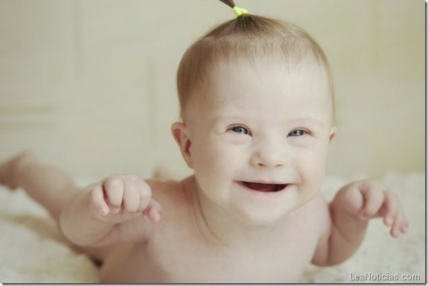 ¿Conoces qué es la trisomía?