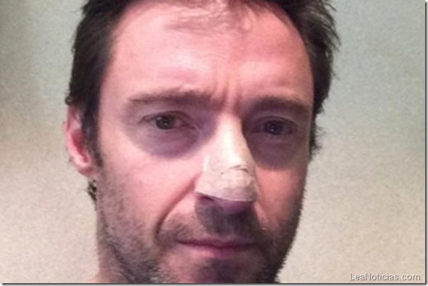 hugh jackman