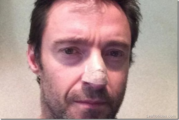 hugh jackman