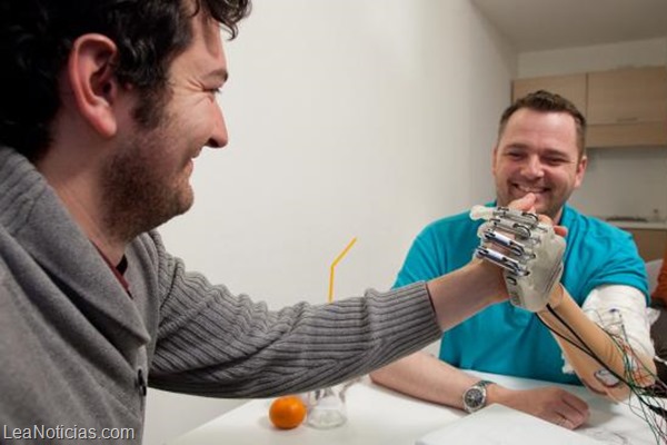 bionic hand