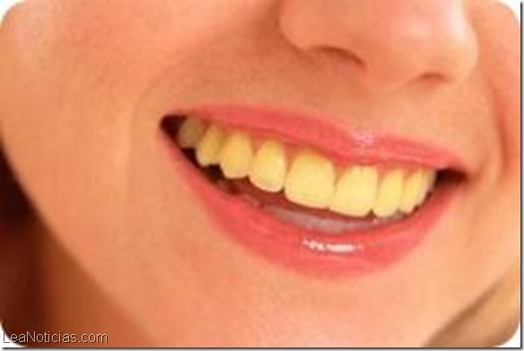 Los-dientes-amarillos