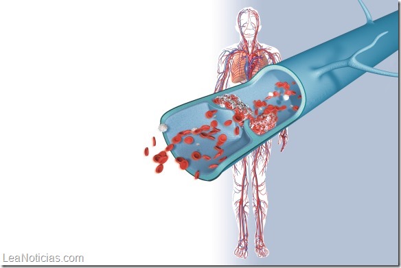 Cardiovascular system