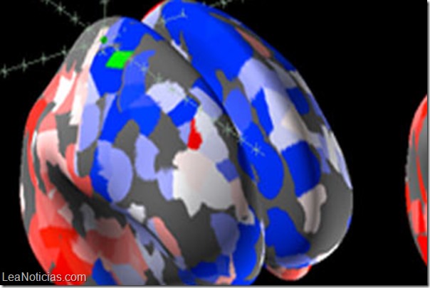 cerebro humano