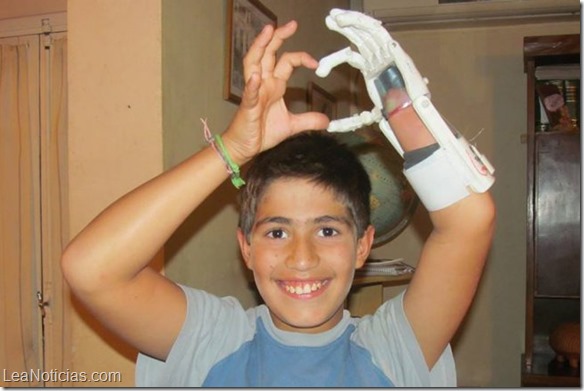 Argentinos producen prótesis de manos con impresora 3D