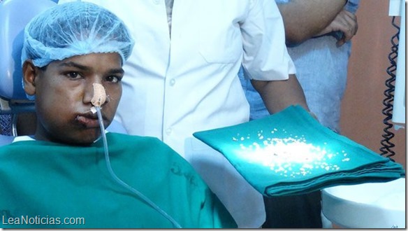 extraccion dientes india 1