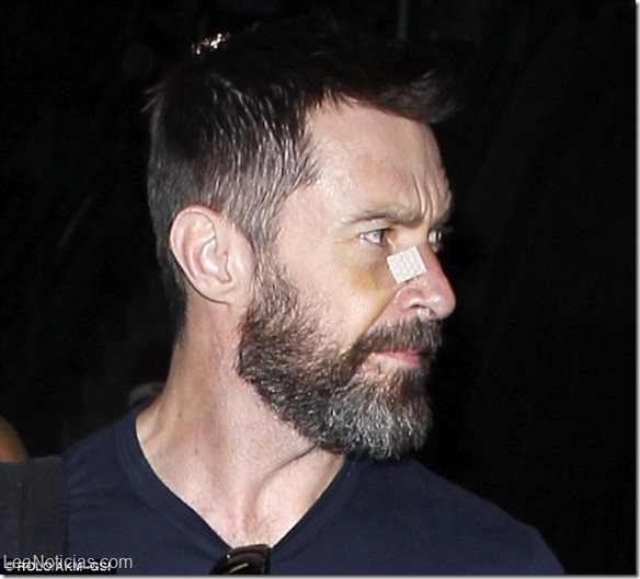 Hugh Jackman 1