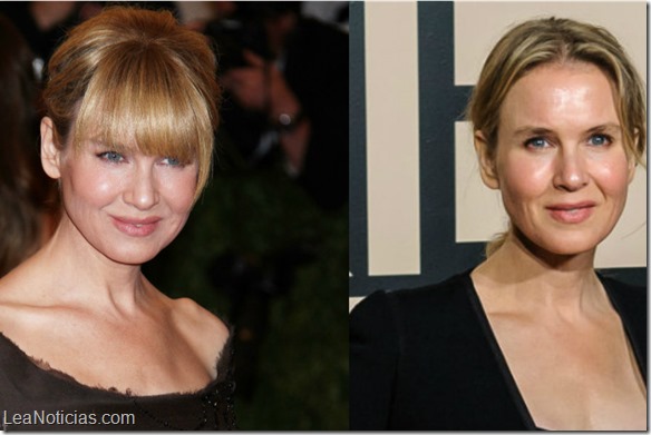 Renee-Zellweger-Before-and-After