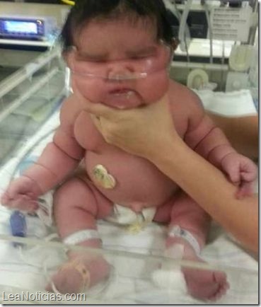 Nace-bebe-kilos-hospital-Unidos_