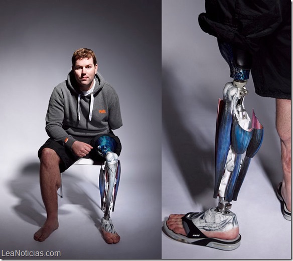 Alternative-Limb-Project_removable-muscle_FullyM_002