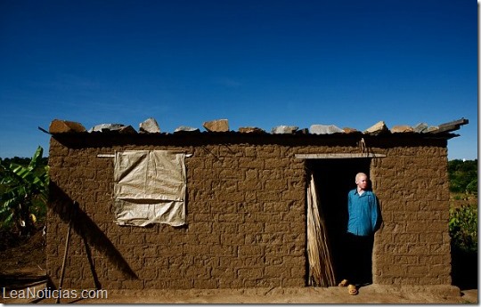 albinos tanzania 1