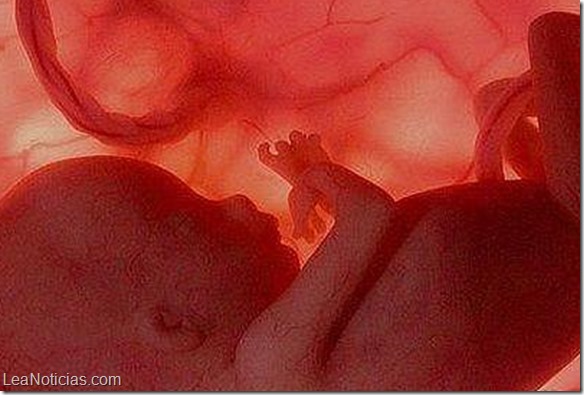 feto-bebe--644x362