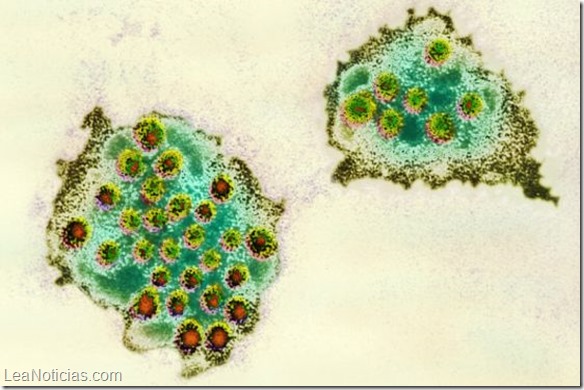 gastroenteritis_norovirus_624x351_spl