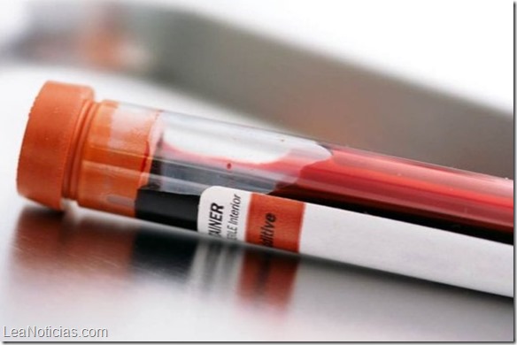 Análisis de sangre detecta 86 % de los cánceres de ovarios