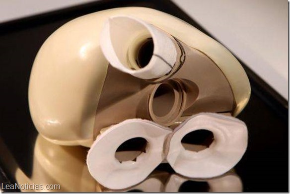 Cirujanos franceses realizan el tercer implante de un corazón artificial