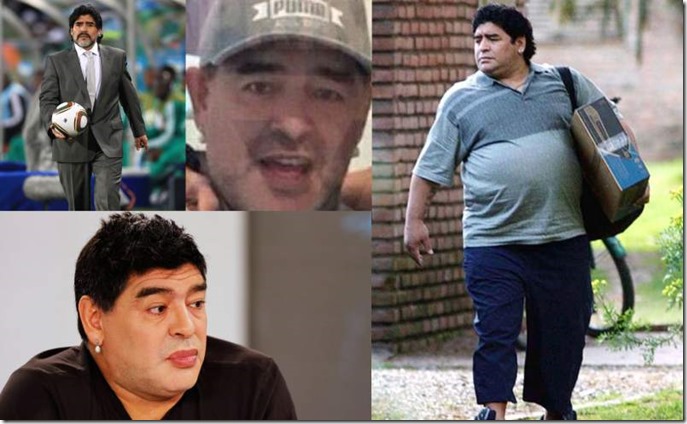 Maradona se engrapa el estómago en Venezuela