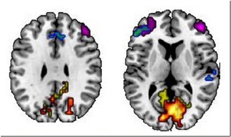 cerebro