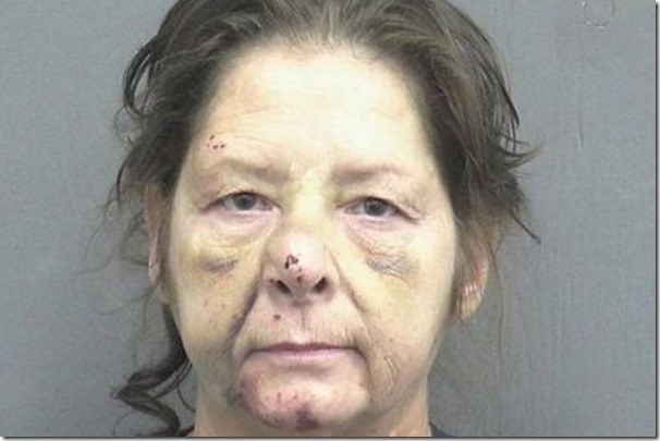 Mujer arranca de un mordisco dos dedos de un hombre en Florida