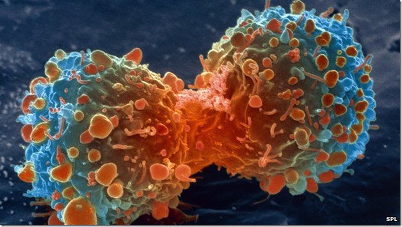 10 síntomas del cáncer que pueden pasar desapercibidos