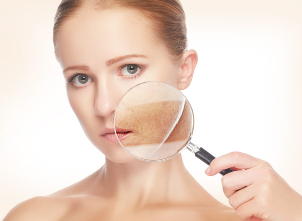 Cinco recomendaciones para evitar las manchas en la cara