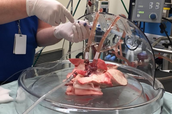 Brasileños desarrollan una técnica para descontaminar órganos trasplantados
