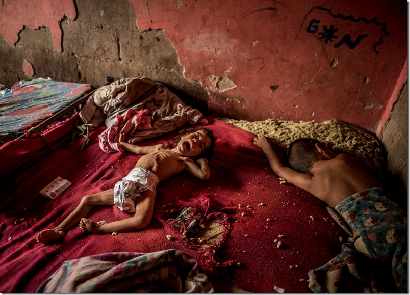 nino-enfermo-venezuela-foto-meridith-kohut-the-new-york-times