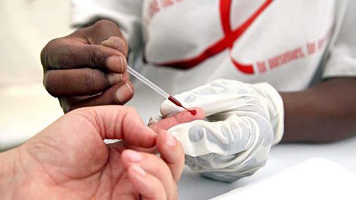 Experto: Estamos cerca de erradicar el VIH pero lejos de hallar su cura