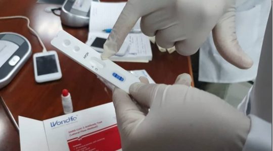 Recomiendan pruebas moleculares a venezolanos que retornen al país en medio de la pandemia