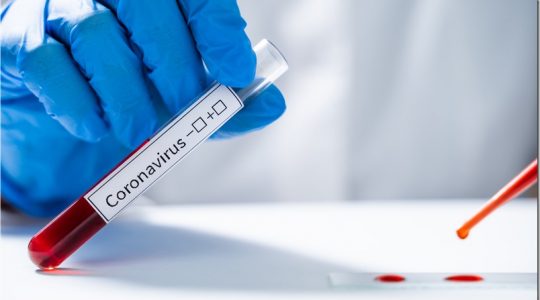 España: Sólo 123 muertos por coronavirus en las últimas 24 horas