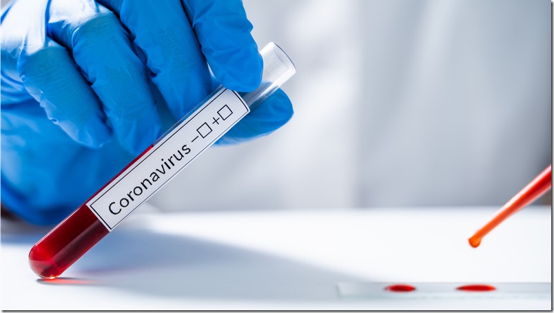 Laboratory assistant tests blood for new coronavirus from China 2019-nCoV
